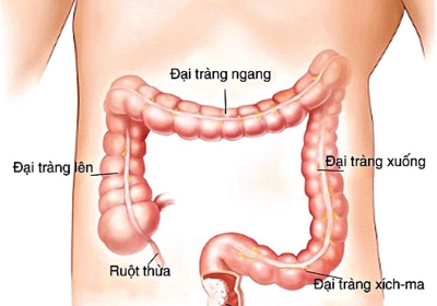 Ung thư trực tràng